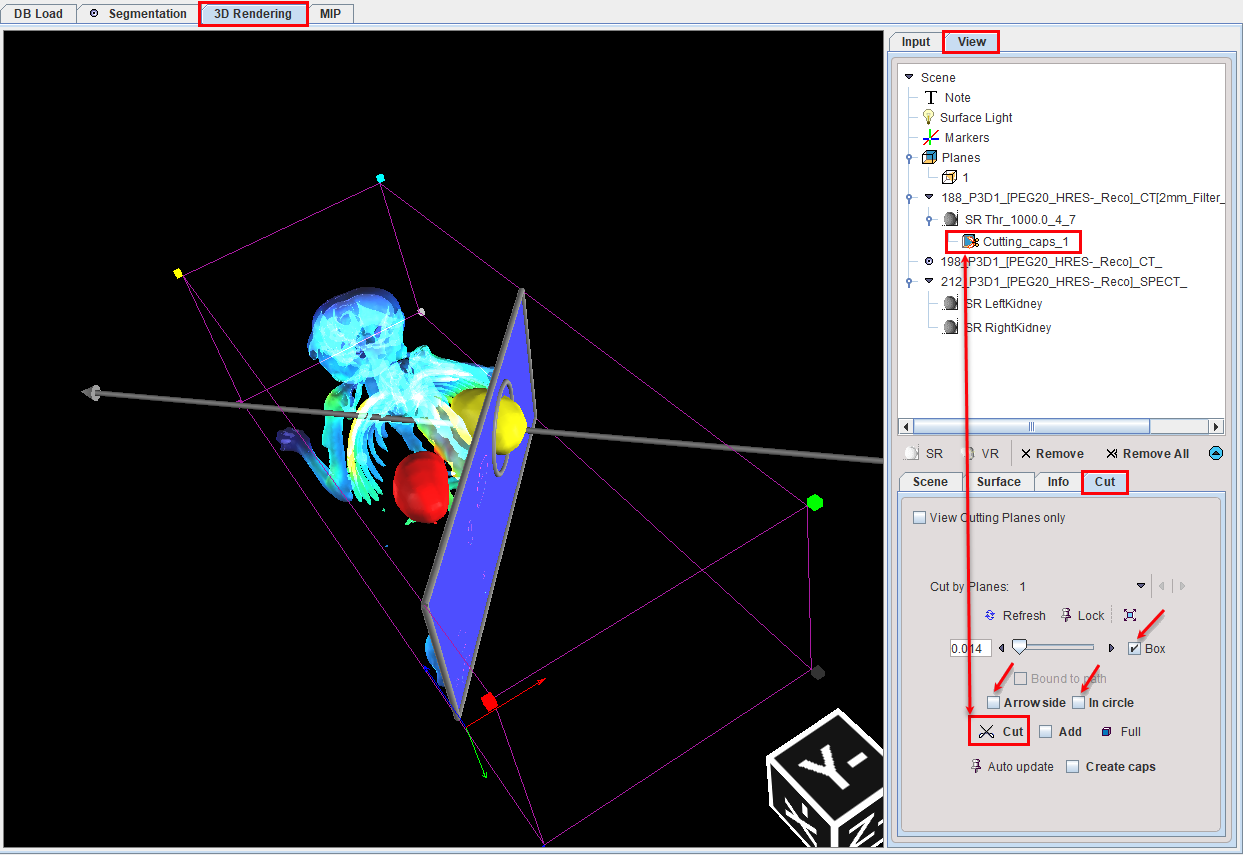 ObliqueCuttingPlanes3