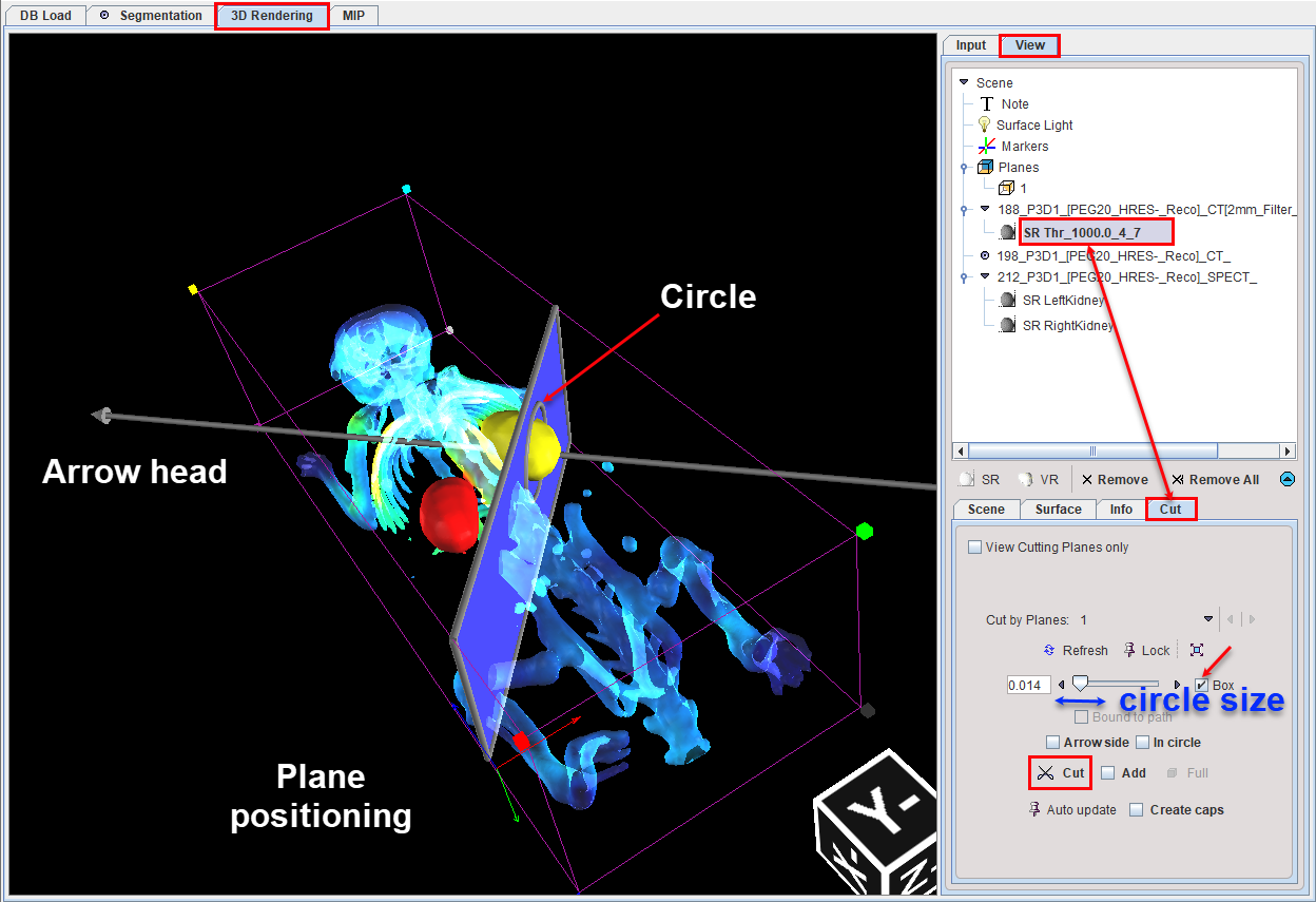 ObliqueCuttingPlane2