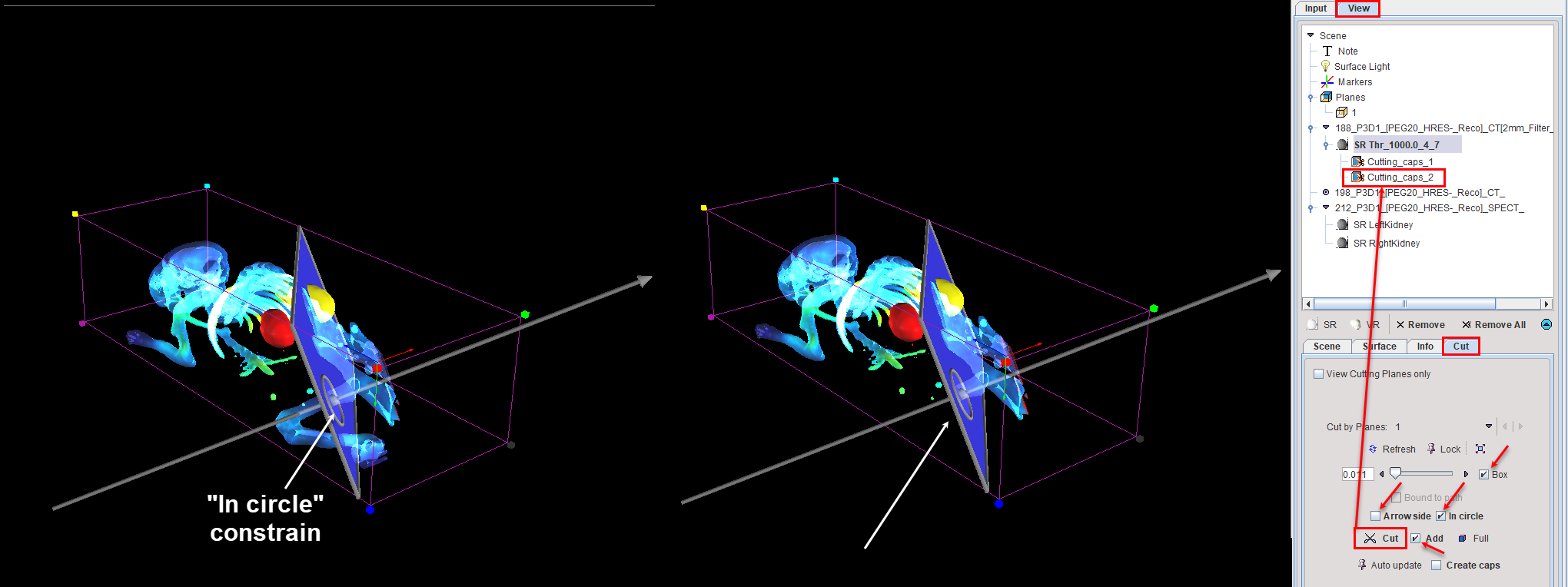 ObliqueCuttingPlane