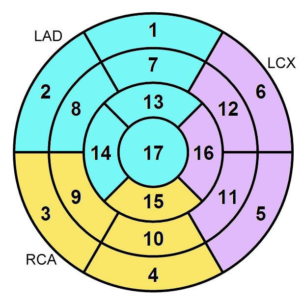 PCARD 17-segment Model Polar Plot