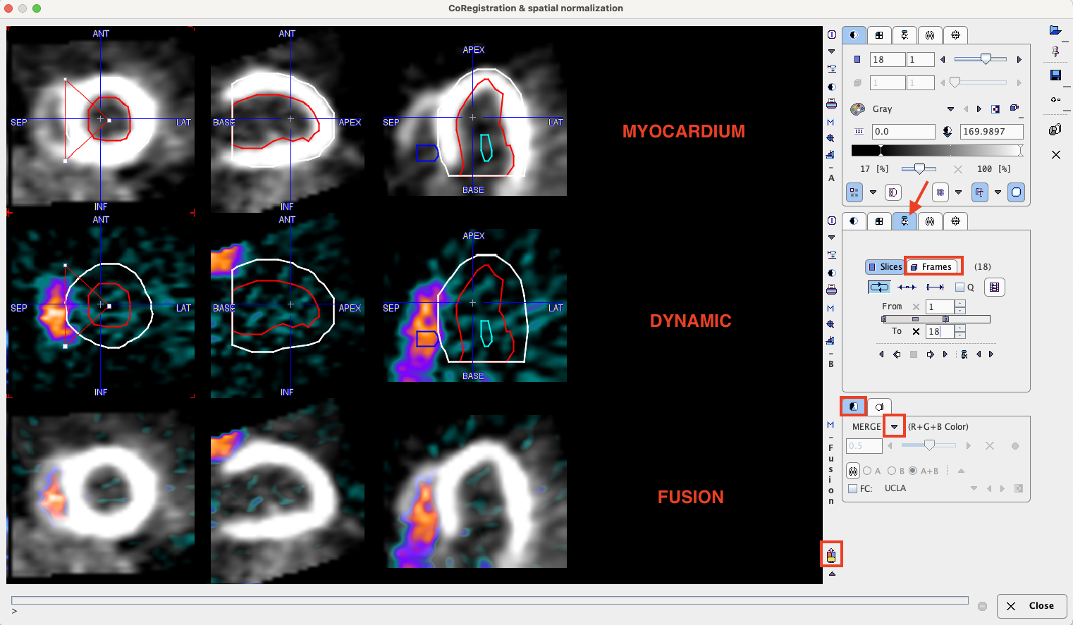 PCARD Data in Fusion