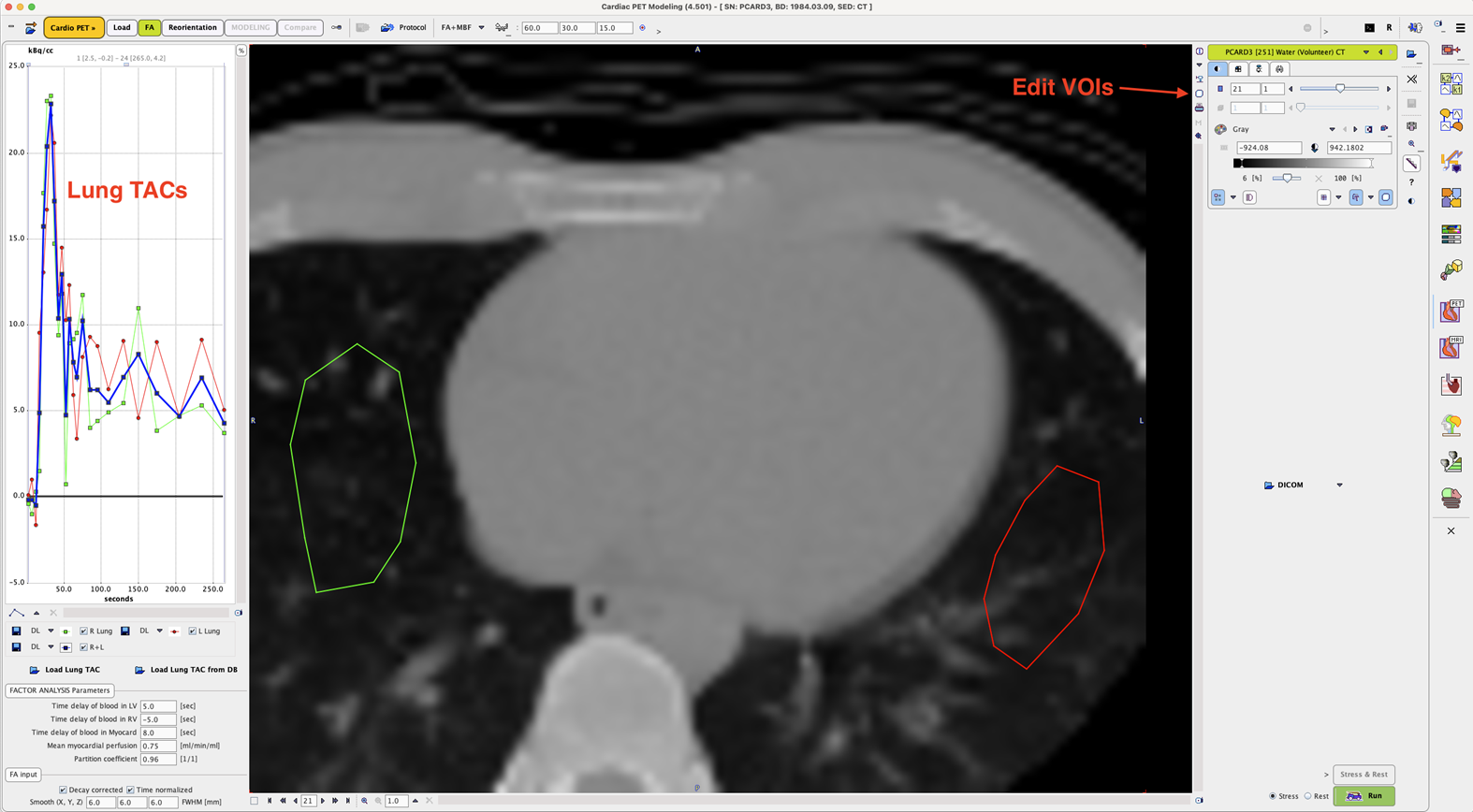 PCARD Lung VOI Definition