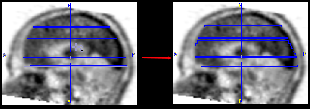 Contour Definition